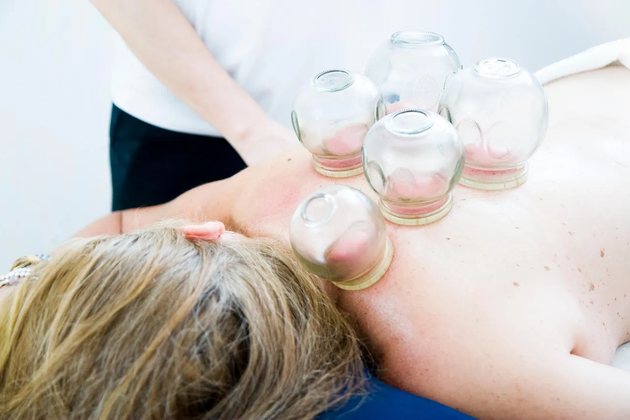 shatavariayurveda.com -cupping-therapy
